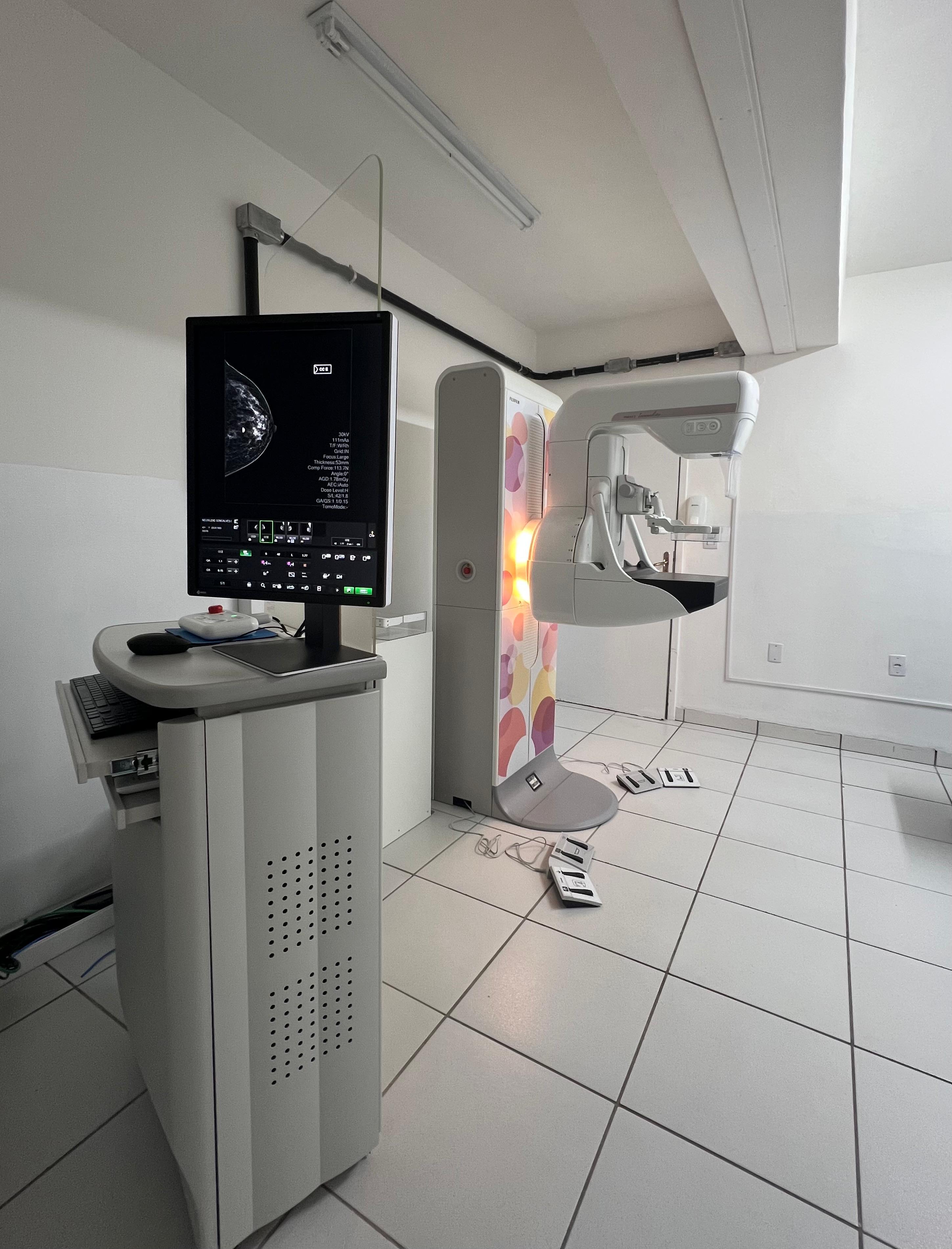 Hospital Nossa Senhora do Carmo moderniza serviço de mamografia com novo equipamento